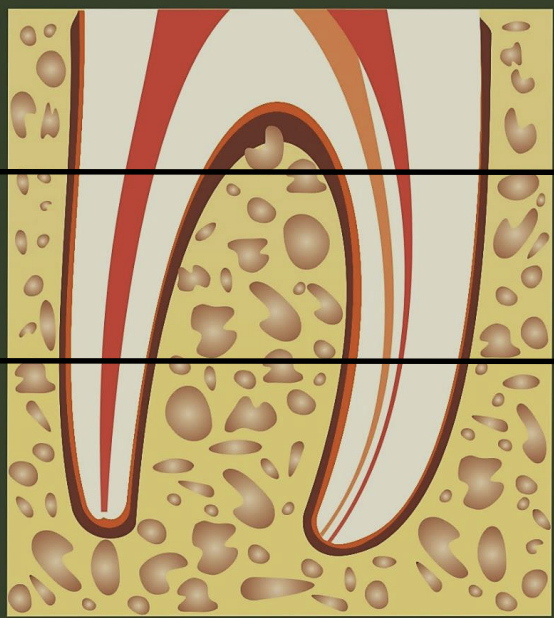 <p>what are the thirds of root canals?</p>