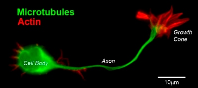 <p>Neuronen i CNS bildas på ett ställe och migrerar till ett annat. De växer i särskilda riktningar som avgörs av axonets <strong>tillväxtkon</strong> (en specialiserad ände), den påverkas av attraherande eller bortstötande signaler. Det sker olika kontakter på väg till målområdet.&nbsp;</p><p>Det sker flera olika processer i CNS under utvecklingen;<br></p><ul><li><p>Proliferation</p></li><li><p>Migration av omogna neuron och gliaceller, det sker <strong>differentiering</strong> genom expression av receptorer och signalsubstanser</p></li><li><p><strong>Synaptogenes</strong>: uppbyggnad av neuronala kontakter</p></li><li><p><strong>Apoptos</strong>: reglerar antalet neuron genom svar på neurotrofa faktorer, tex<strong> neurotrofiner eller neurokiner</strong></p></li><li><p>Gliacellsutveckling</p></li><li><p>Myelinisering</p></li></ul><p></p>