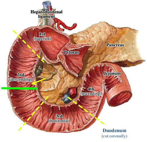 <p>-tethered to body wall by band of skeletal tissue from the right crus of diaphragm, the <strong>suspensory ligament </strong>(of Treitz)</p><p>-duodenojejunal junction located at level of subcostal plane (L2)</p><p>-mesentery of jejunum begins at duodenojejunal junction (asterisk indicates torn mesentery)</p>