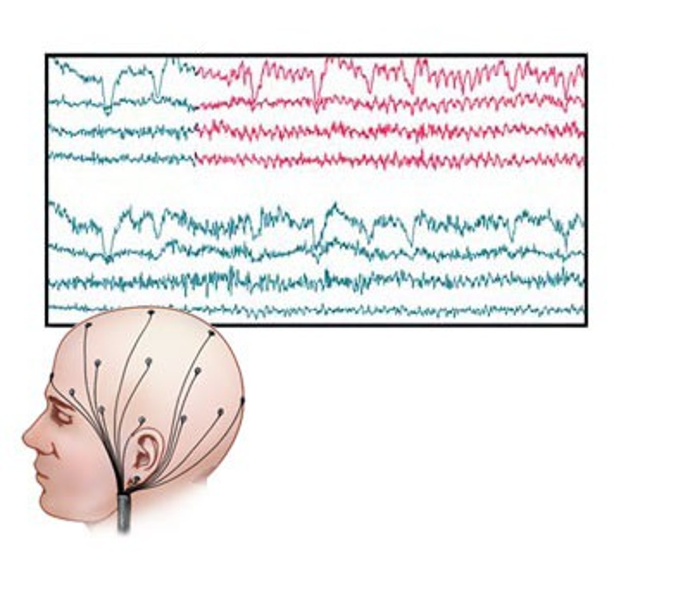 <p>A recording of the activities in the brain / shows us how active the brain is IN HUMANS</p><p>Disadvantage: doesn't show you where the activity is occuring</p>