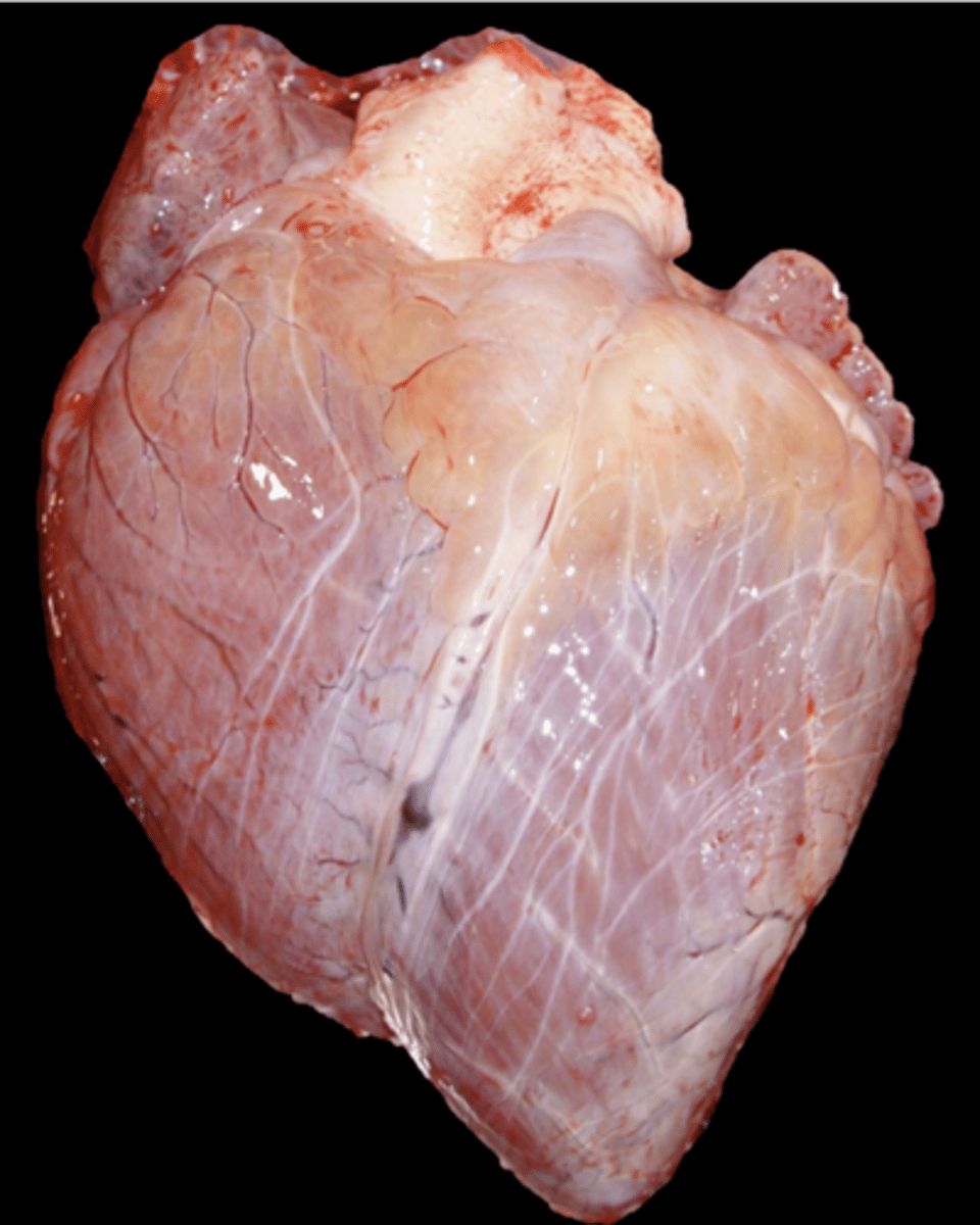 <p>Epicardial fat appears gelatinous</p>
