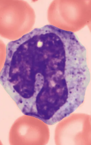 <ul><li><p>A type of White blood cell (Leukocytes)</p></li></ul><p></p><p><u>Agranulocytes</u></p><ul><li><p>3-8% of leukocytes</p></li><li><p>The largest leukocytes</p></li><li><p>Leave circulation, enter tissues, and differentiate into <strong>macrophages </strong>with prodigious appetites</p><ul><li><p><strong>macrophages</strong> are actively phagocytic cells, crucial against viruses, intracellular bacterial parasites, and chronic infections.</p></li><li><p><strong>macrophages </strong>can activate lymphocytes to mount an immune response</p></li></ul></li></ul><p>Characteristics:</p><ul><li><p>U-ish, Kidney-shaped nucleus</p></li><li><p>Abundant pale blue cytoplasm</p></li><li><p>darkly stained purple nucleus  </p></li></ul><p></p>