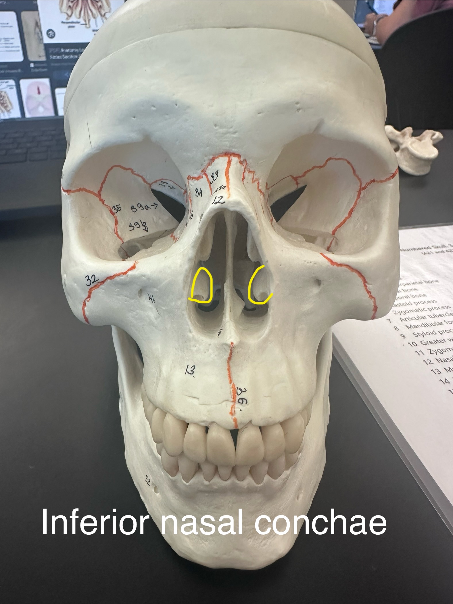 <p>Inferior Nasal Conchae</p>