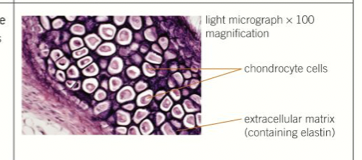 <p><span>- connective tissue found in outer ear, nose and at ends of bones<br>- contains fibres of proteins elastin and collagen&nbsp;<br>- firm and flexible tissue composed go chondrocyte cells in extracellular matrix&nbsp;<br>- prevents bones from rubbing together and causing damage</span></p><p></p>