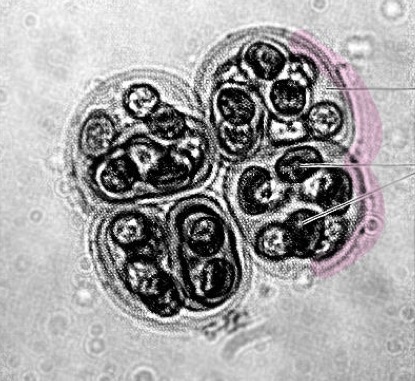 <p>What is the structure highlighted by pink</p>