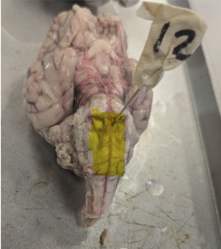 <p>Which part of the brain is highlighted? </p>