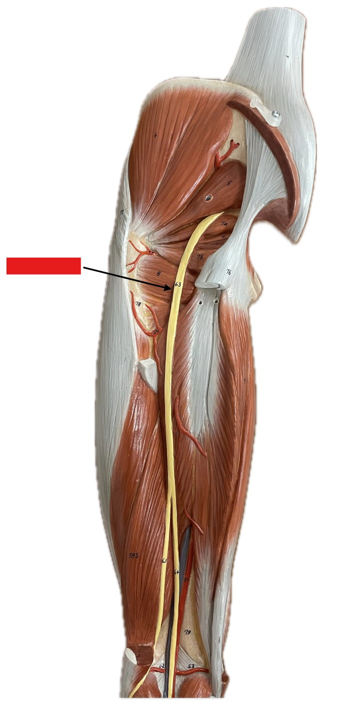 <p>Which nerve of the sacral plexus is:</p><ul><li><p>Largest, back of thigh</p></li></ul><p></p>