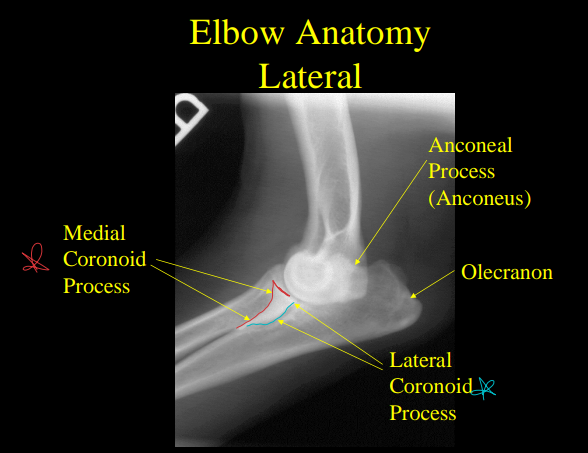 <p>Fragmented Medial Coronoid Process</p>