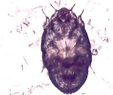 <p><span>Scabies (Sarcoptes scabiei)</span></p>