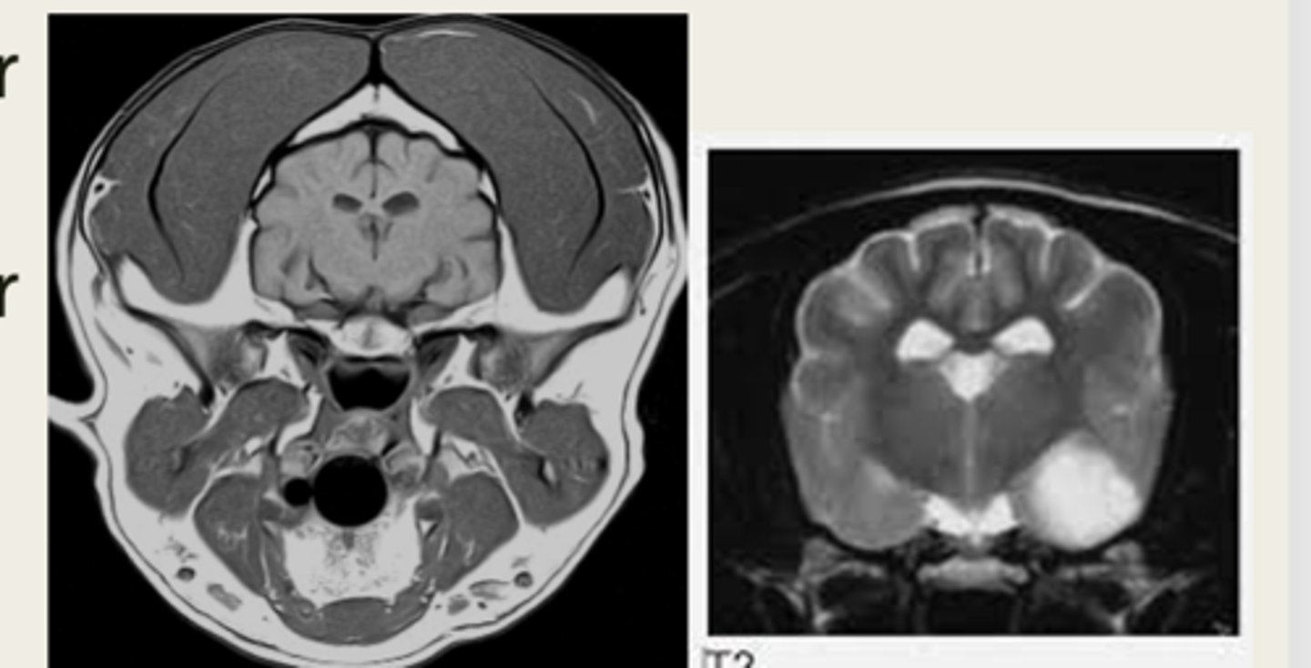 <p>which MRI image is T1 or T2 weighted?</p>