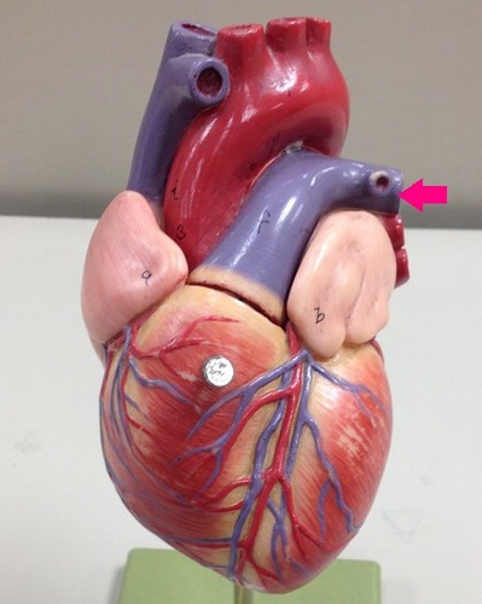 <p>Identify the vessel. Be specific.</p>