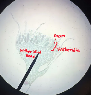<p>Is the Antheridial head part of the sporophyte or gametophyte generation?</p>