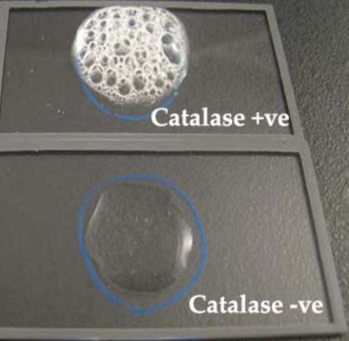 <p>key test in differentiating Gram (+) cocci</p><ul><li><p>substrate is <strong>hydrogen peroxide</strong></p></li><li><p>distinguishes Staph from Strep</p></li></ul>