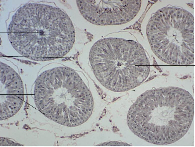 <p>Identify the organ in the micrograph</p>