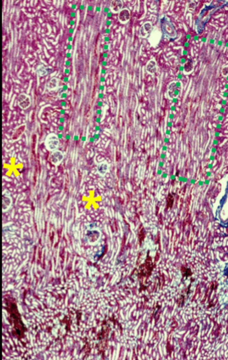 <p>straight tubules and collecting ducts (green boxes)</p>