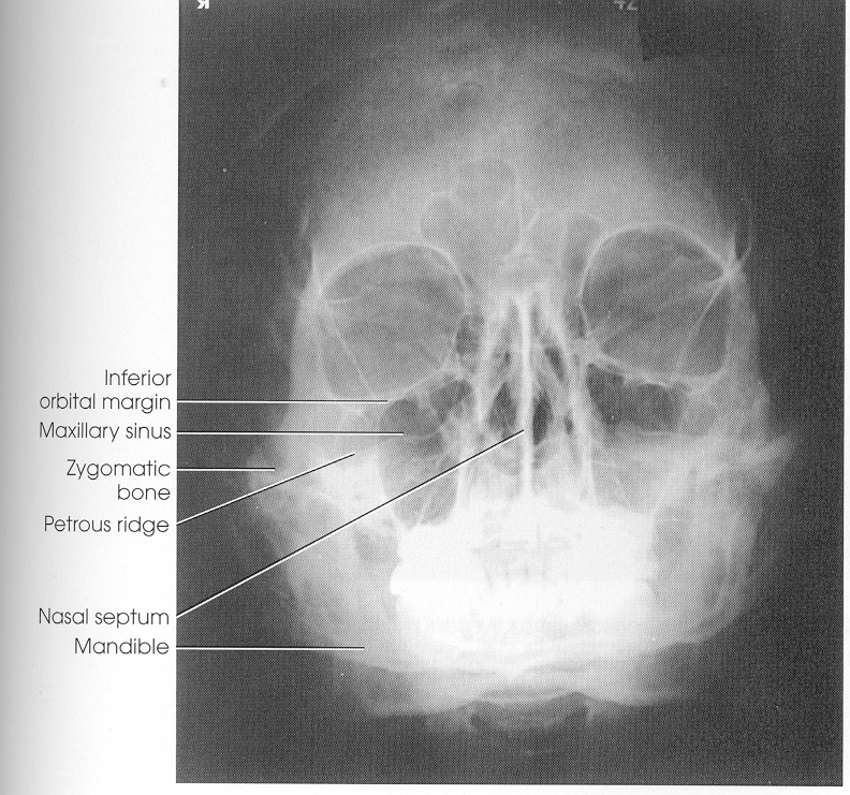 <p>xray</p>