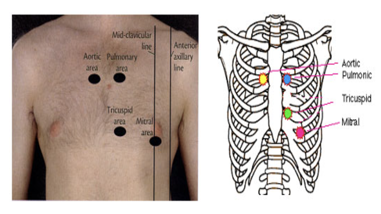 <ul><li><p>The sound of the heart contracting and the valves opening and closing produces a characteristic "lub-dub" sound</p></li><li><p>Lub is associated with closure of the AV valves</p></li><li><p>Dub is associated with closure of the SL valves</p></li></ul>