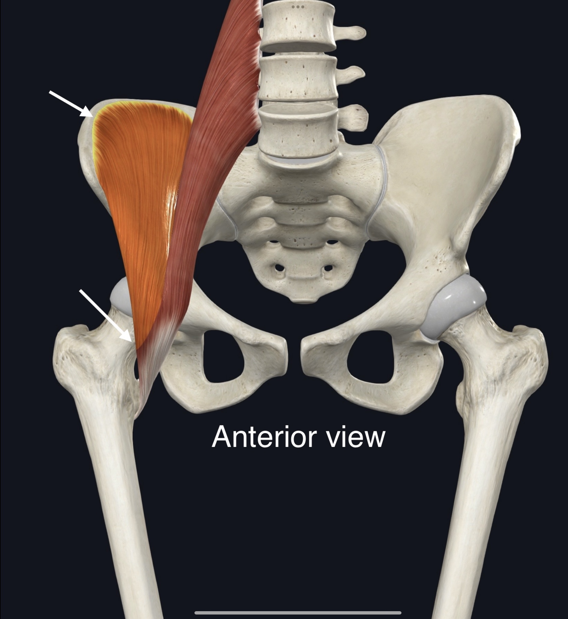 <p>Name the muscle, origin and insertion</p>