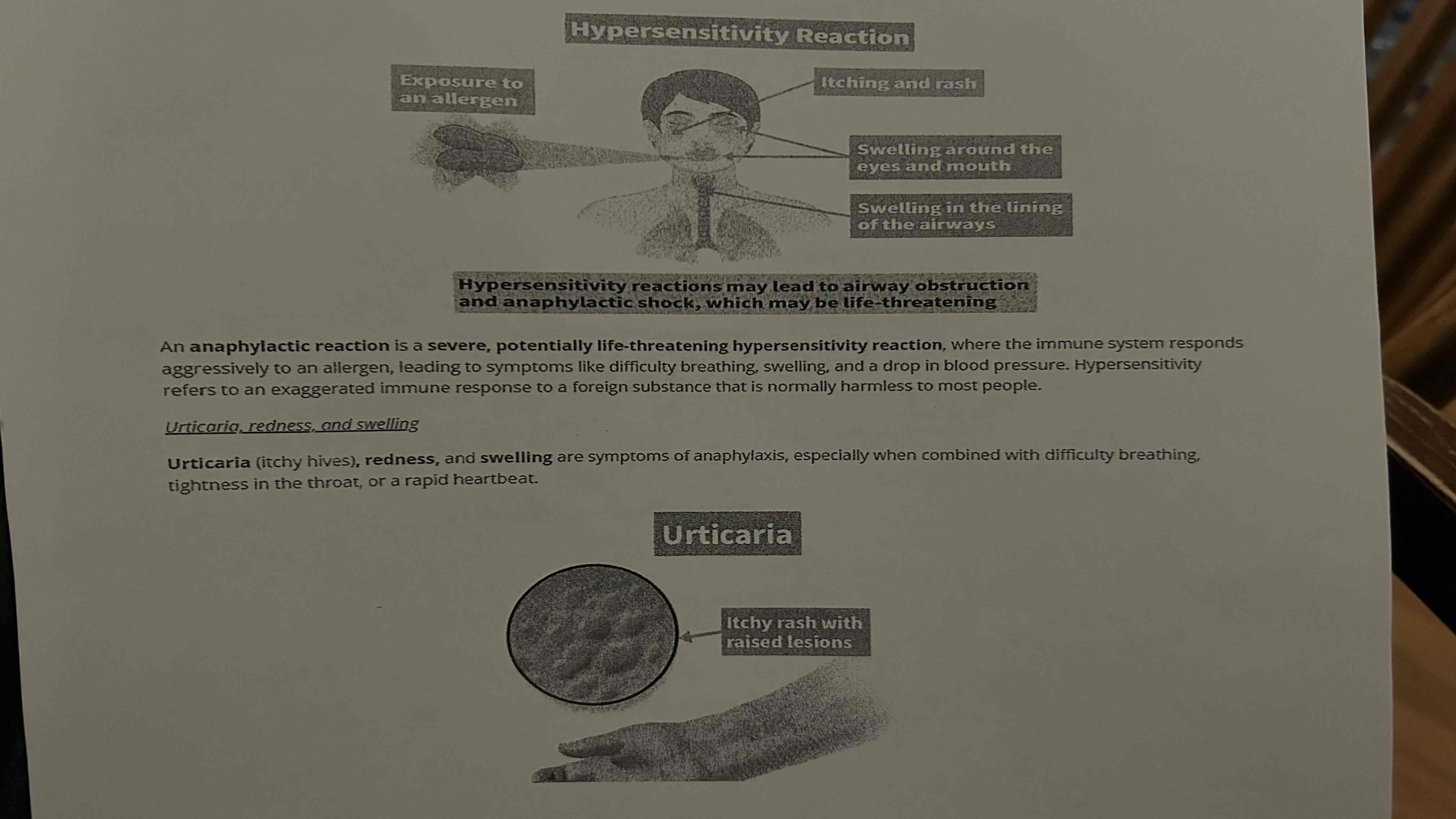 <p>May lead to airway obstruction and anaphylactic shock, which may be life- threatening. </p>