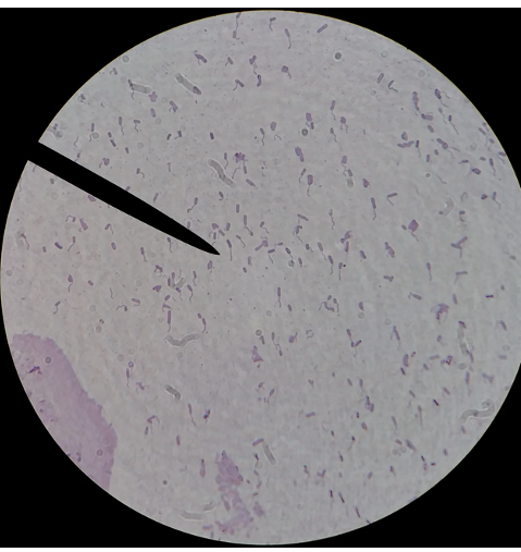 <p>What type of flagella does this species have?</p>