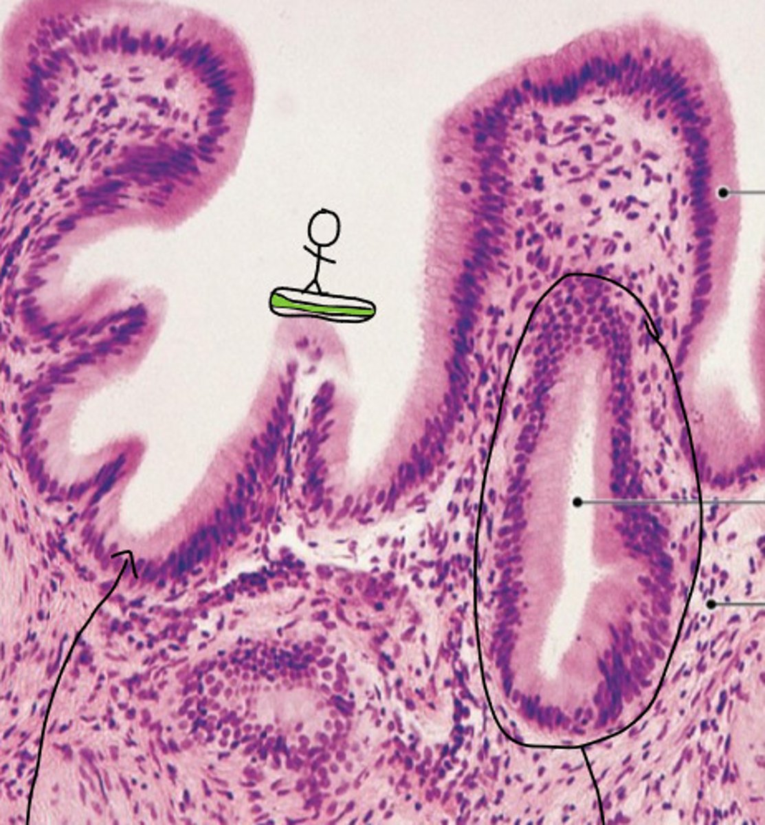 <p>ID the Histology</p>