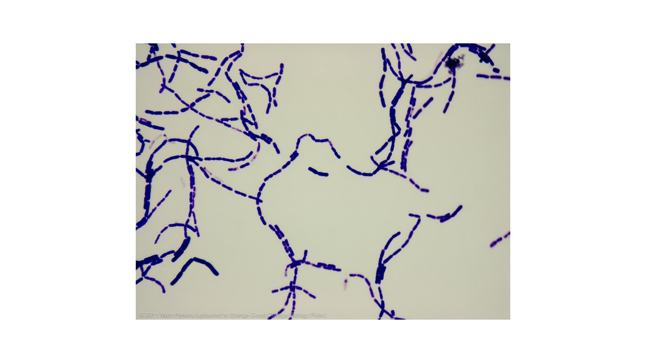 <p>gram positive </p>