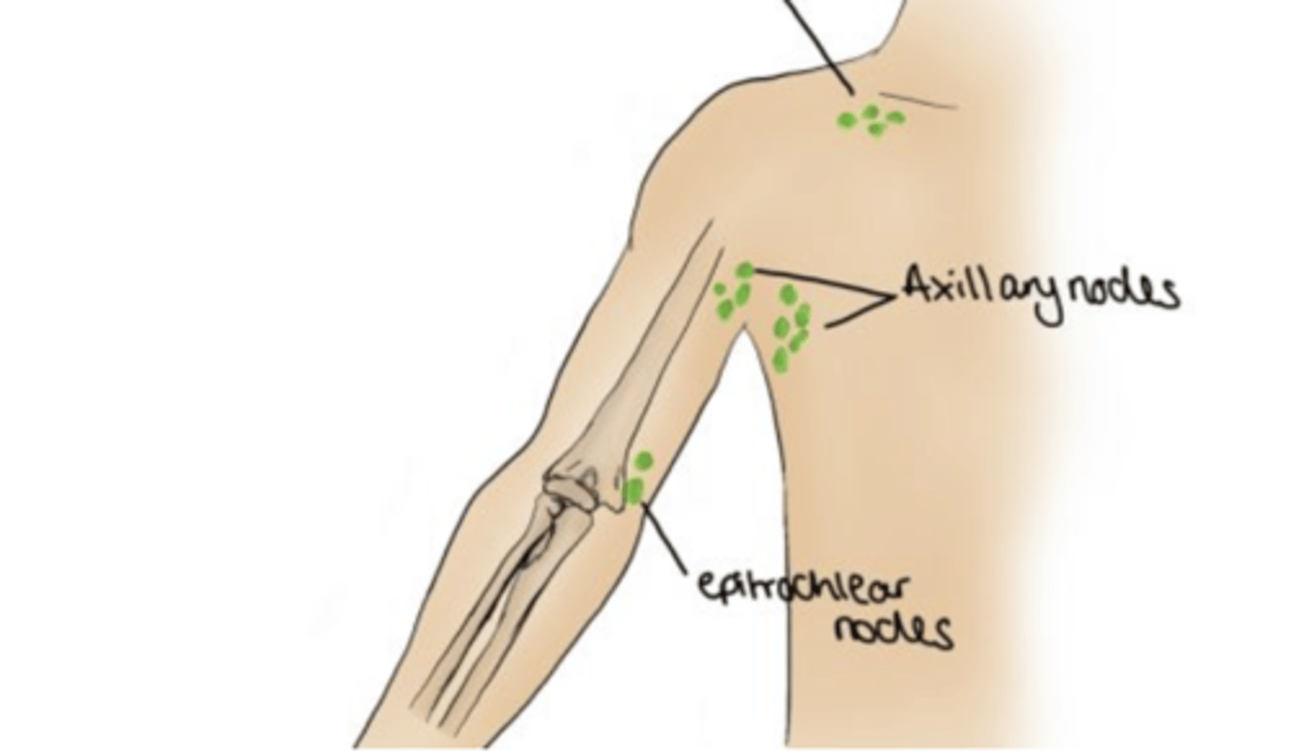 <p>In the anterior view, the capitulum (medial) and the trochlea (lateral) are observed, with the epitrochlear process (or medial epicondyle) being the most prominent.</p>