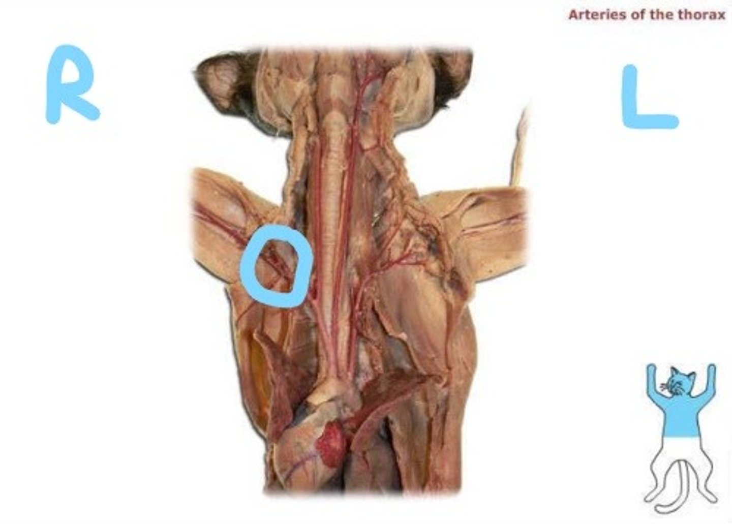 <p>the name of the subclavian after it passes in front of the first rib</p>