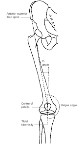 <p>Valgus angle</p>