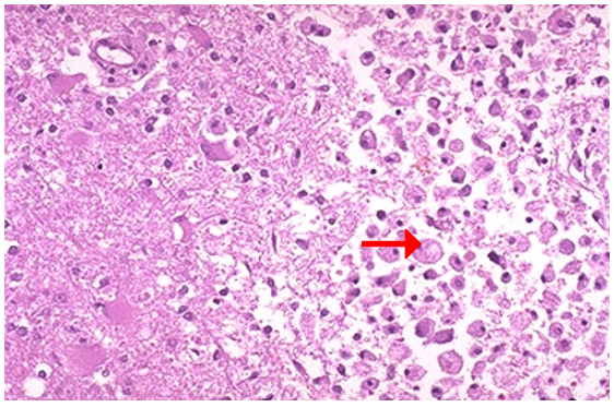 <ol><li><p>What type of cell death and CD</p></li><li><p>What are the cells on the right that cleans up necrotic cellular debris?</p></li></ol>