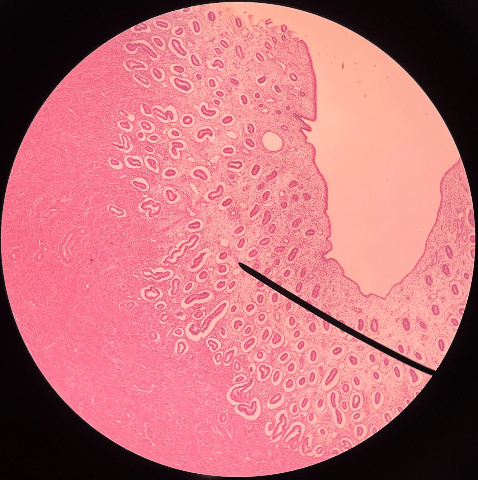 • Slide histology of the uterus during its proliferation (follicular) phase.

• The innermost layer of the uterus.

• Contains glands.