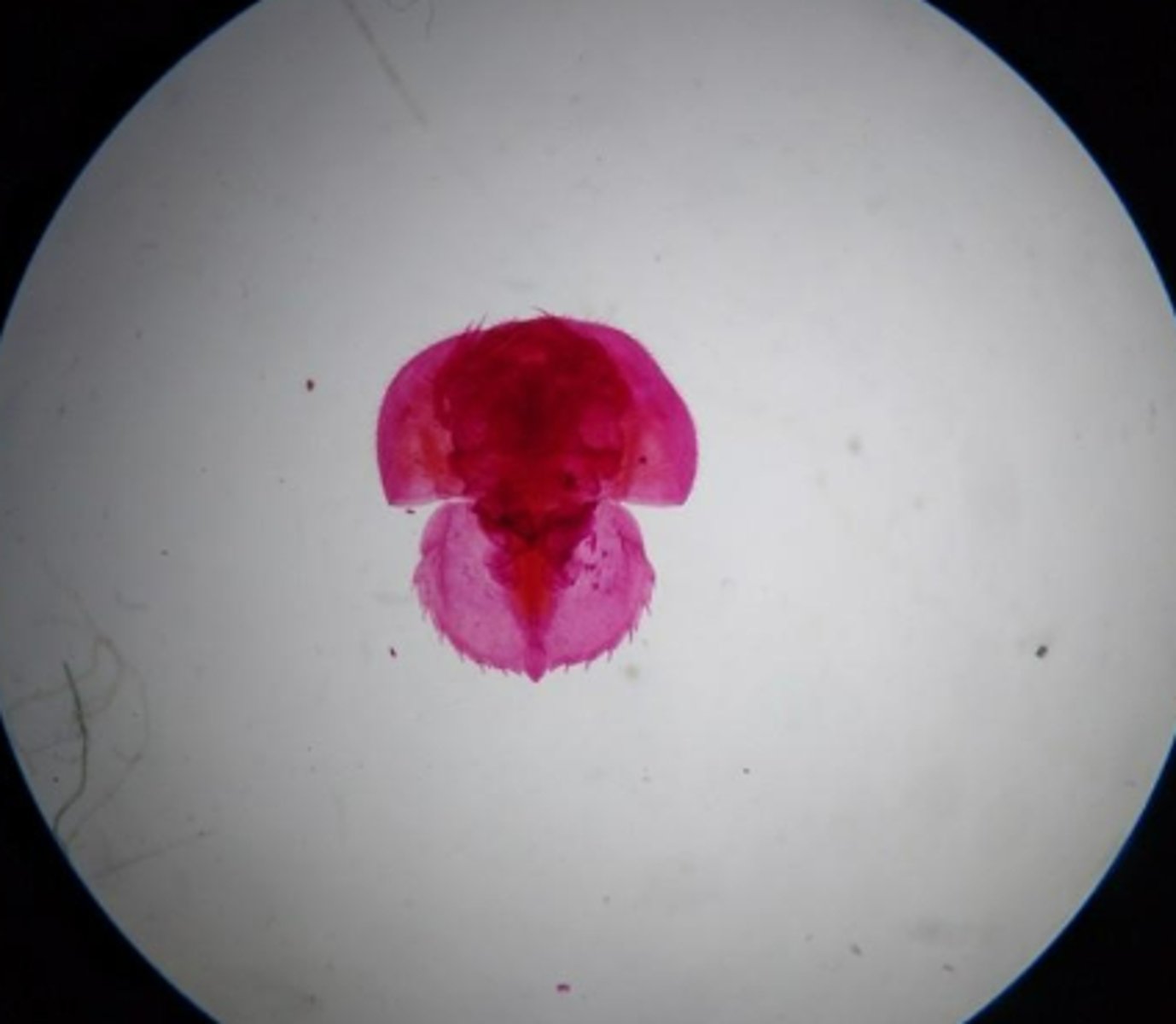 <p>What Phylum, Subphylum, and Class is this larva in?</p>