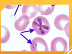 <p>Babesia spp.: B. canis, B. gibsoni, B. bovis </p>