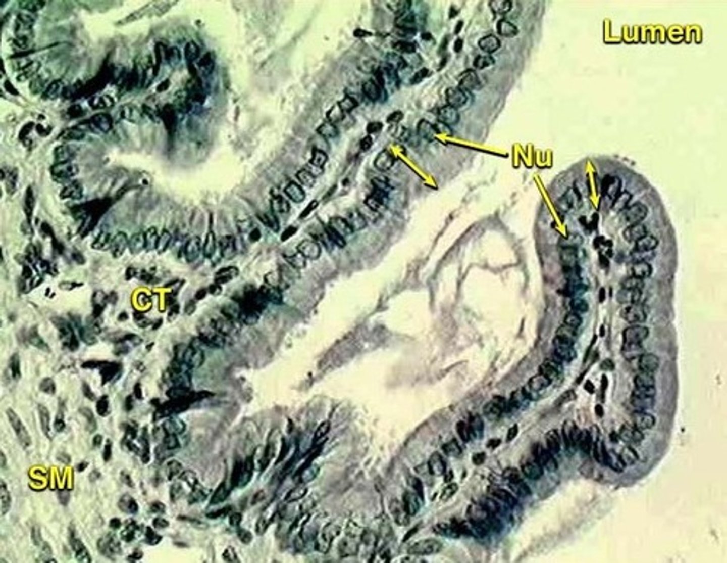 <p>interior (lumen) of the gall bladder</p>