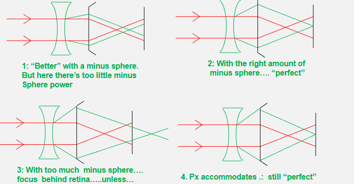 <p>which lens is better for the patient&nbsp;</p>
