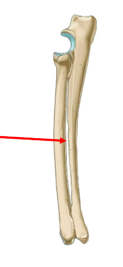 <p>• Space between ulna and radius</p><p>• Readily seen in carnivores and pigs</p>