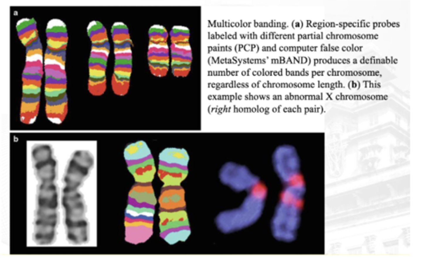 <p>between A and B which is abnormal as per multicolor banding analysis?</p>