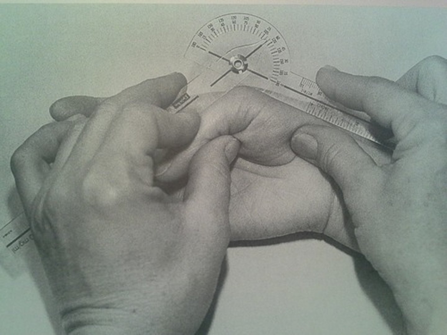 <p>fulcrum: dorsal surface of MCP joint<br>proximal: dorsal midline of metacarpal<br>distal: dorsal midline of proximal phalanx<br><br>supinated</p>