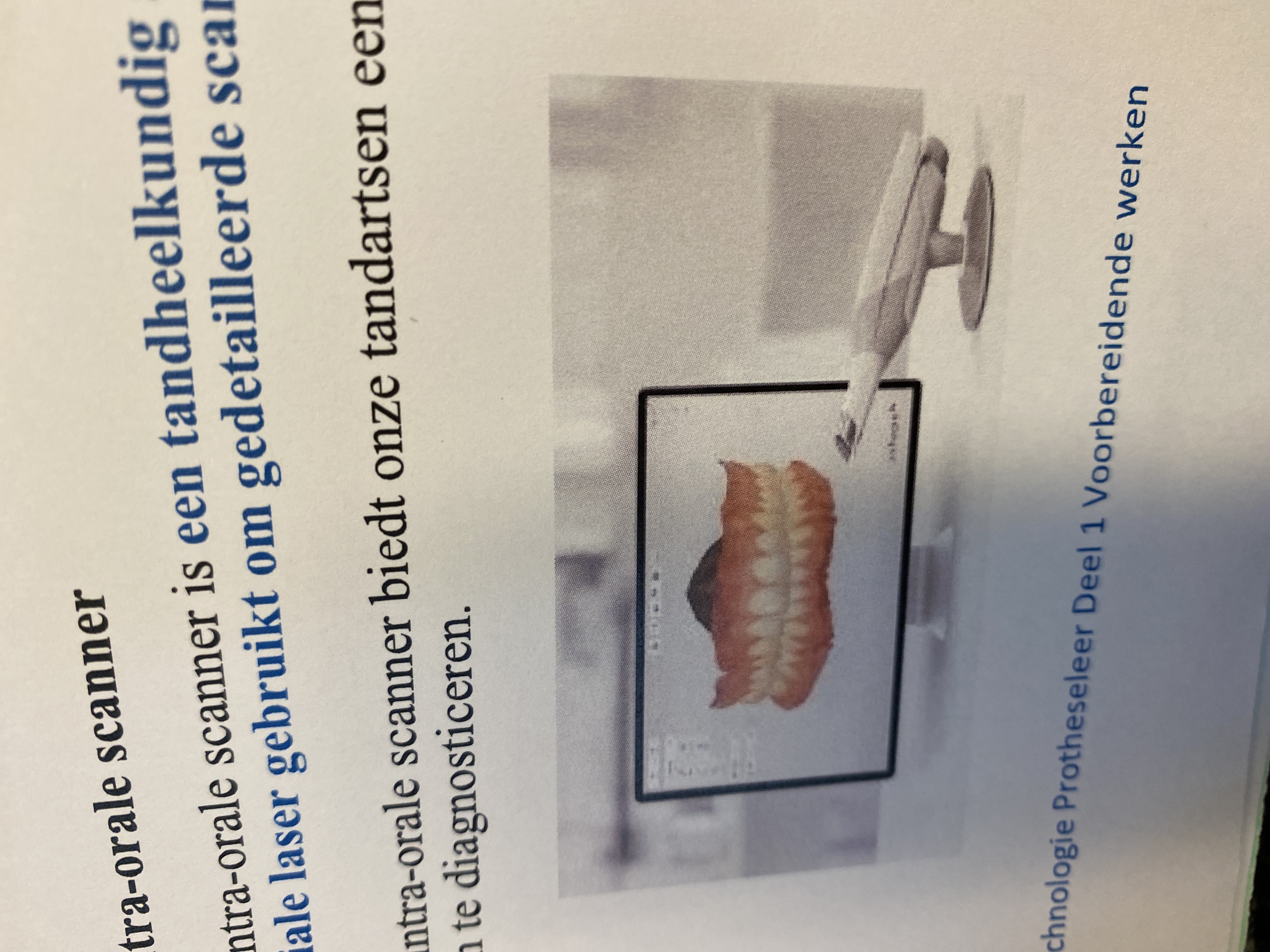 <p>Wat zijn de voordelen van een intra-orale scanner?</p>