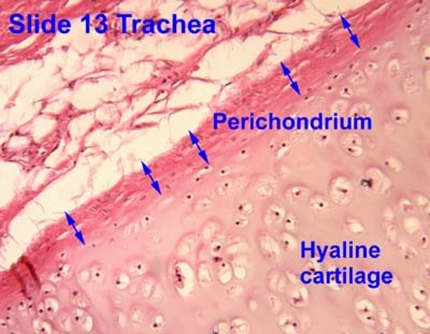 <p>Dense irregular connective tissue membrane covering cartilage</p>