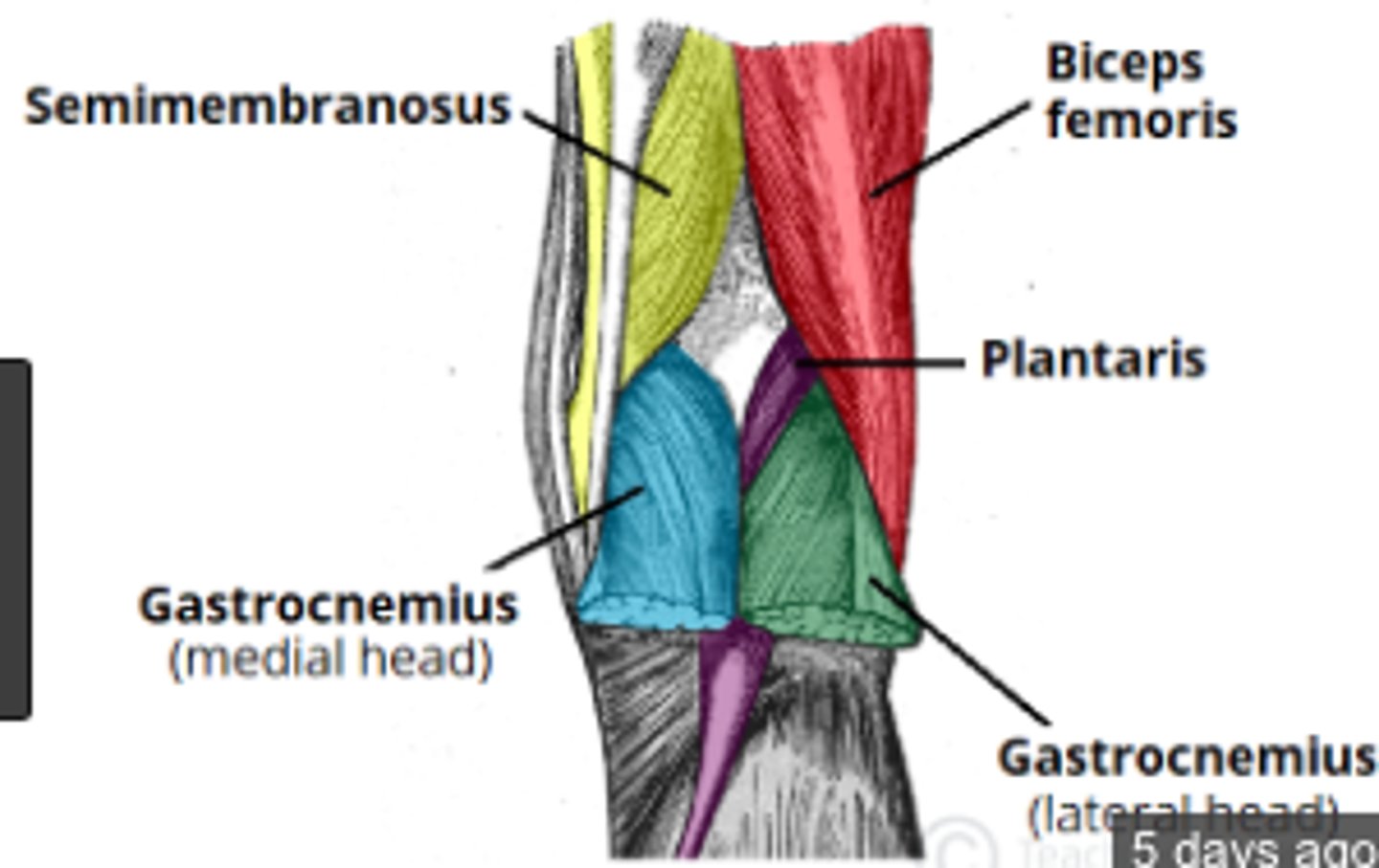 <p>-Superolateral Border: Biceps femoris</p><p>-Superomedial Border: Semimembranosus, Semitendinosus (lateral to semimembranosus)</p><p>-Inferolateral Border: Lateral head of Gastrocnemius</p><p>-Inferomedial Border: Medial head of Gastrocnemius</p><p>Posterior Border: Skin, fascia</p><p>Anterior Border: Popliteal surface of femur, oblique popliteal ligament, popliteal fascia over popliteus, floor of fossa</p>