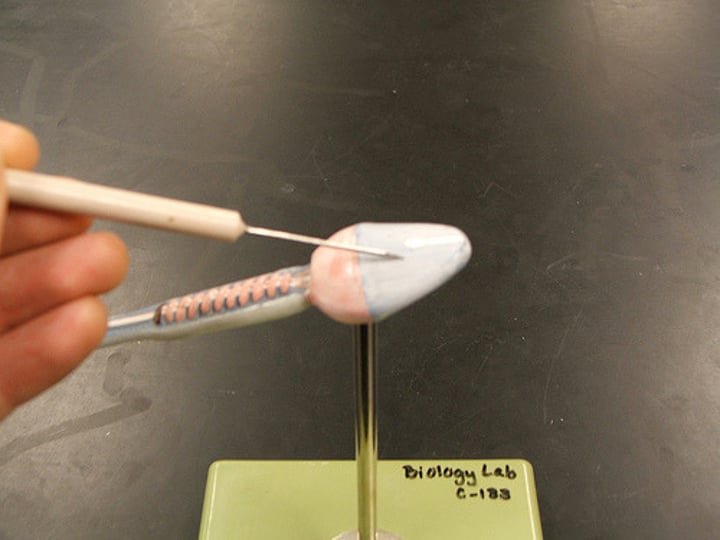 <p>Name the outer structure.</p>