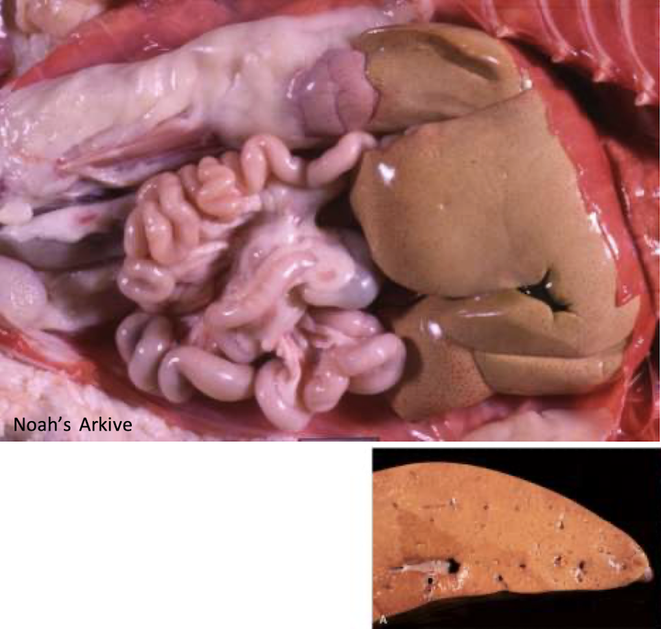 <p>What does this liver show?</p>