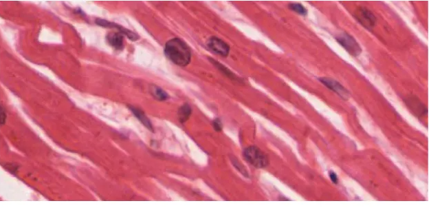 <p>short, single central nucleus, branched, straited </p>