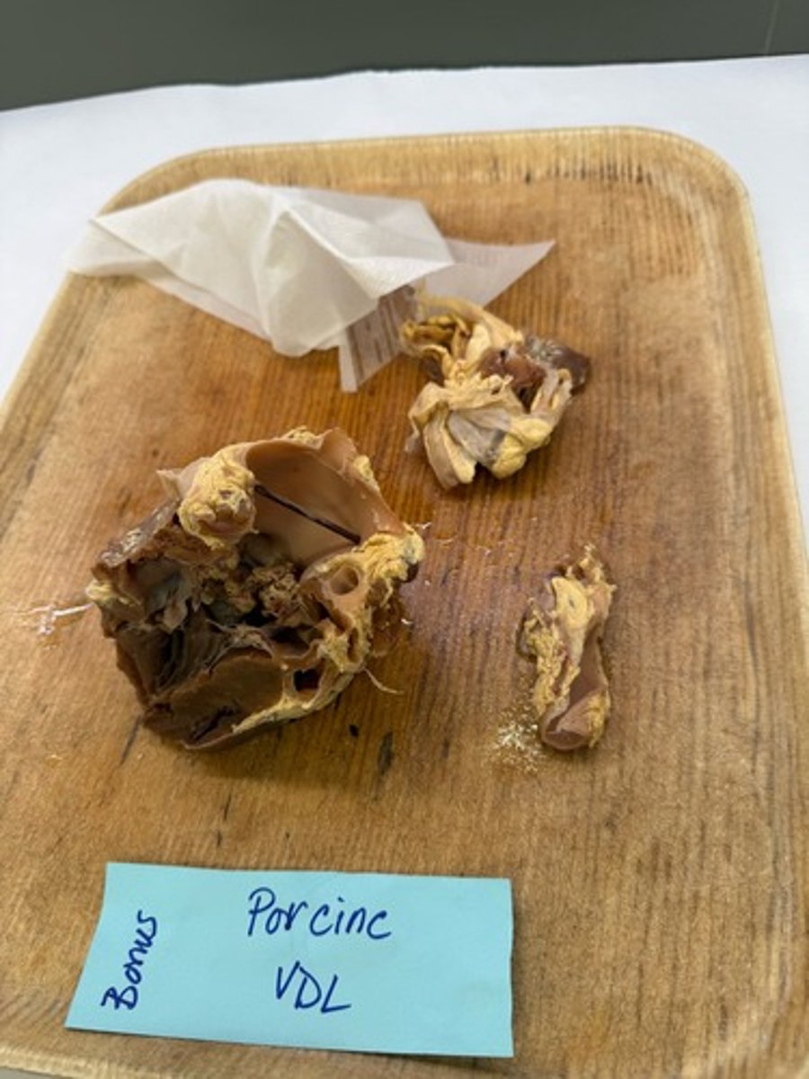 <p>What is this lesion?</p>