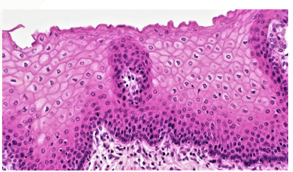 <p>Stratified Squamous Epithelial&nbsp;</p><p>Function: Protection </p><p>Found in: epidermis of skin, lines oral cavity, esophagus and vagina</p>