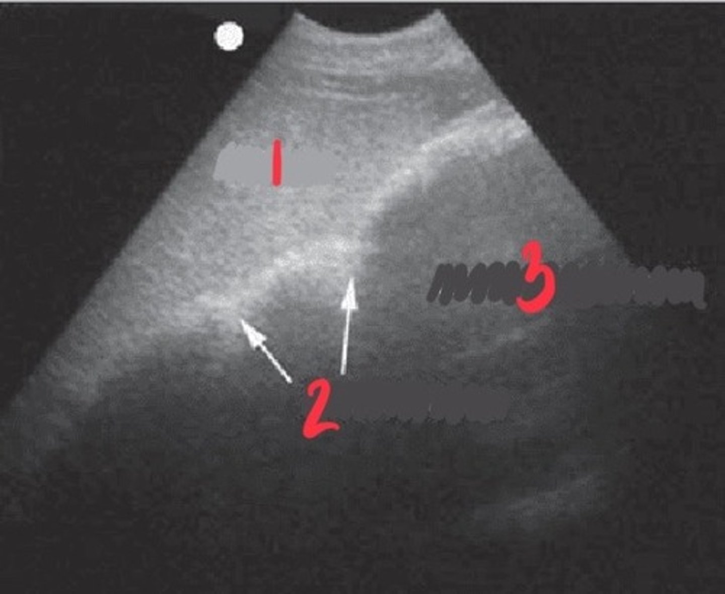 <p>What FLASH view is this in horses and what are the numbers showing you?</p>