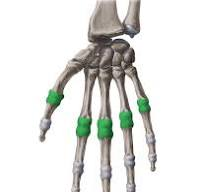 <p>_______/_______ joint - ex. MCP joint ( flexion, extension in sagittal plane and abduction, adduction in frontal plane).</p>