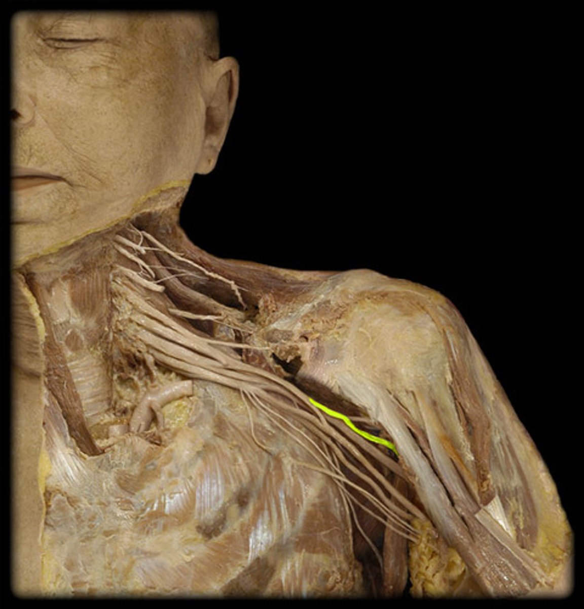 <p>C5-C7</p>