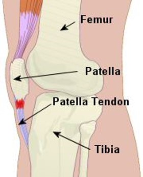 <p>Some common examples include the patella and the pisiform.</p>